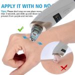 میکرودرم خانگی مدل Multifunctional Cleaning Instrument - Image 4